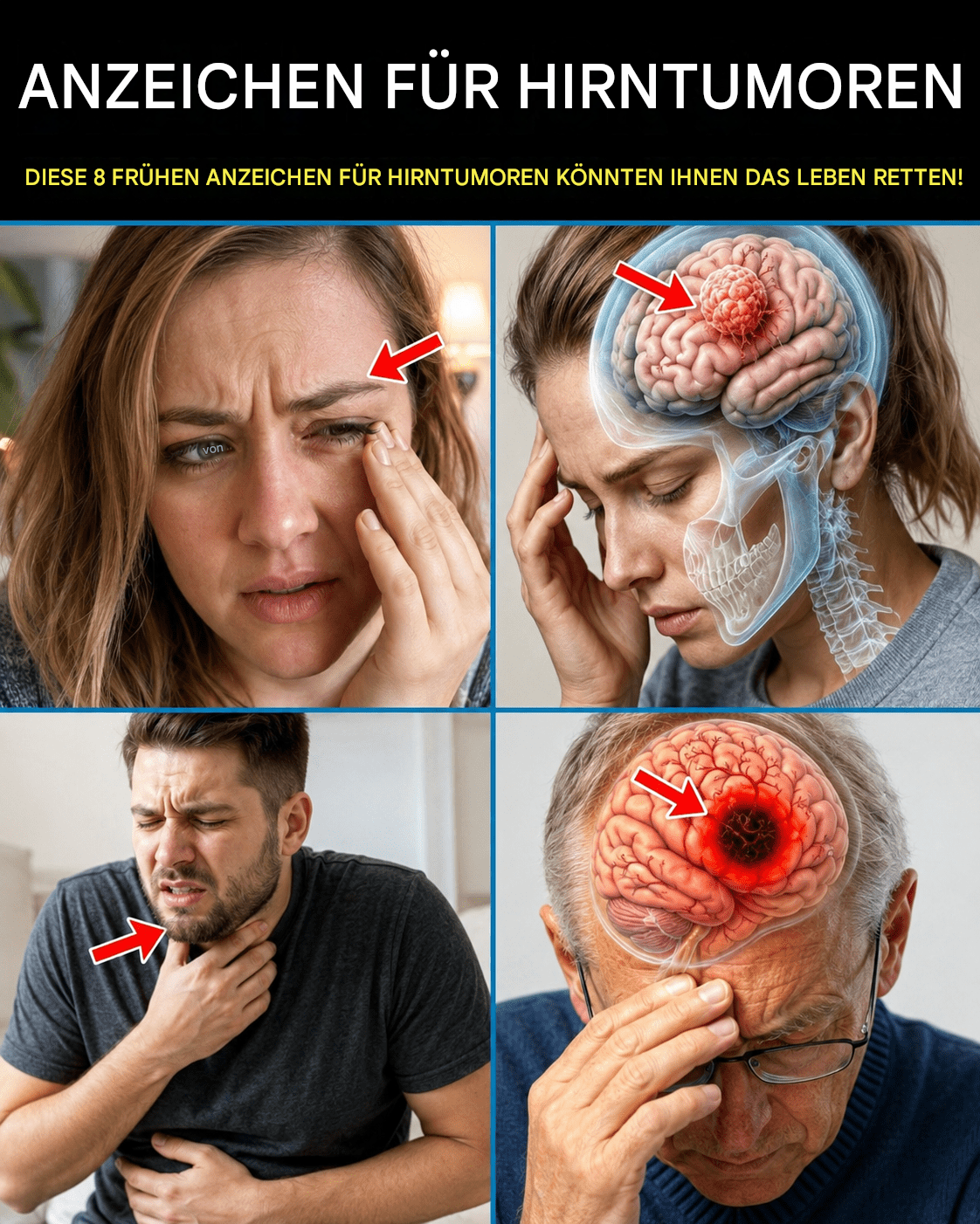 Verpassen Sie nicht diese 8 frühen Warnzeichen eines Hirntumors – sie zu erkennen, könnte Ihr Leben retten.