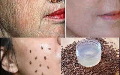 Selbst mit 70 Jahren können Sie es gegen Falten anwenden – Ihre Haut wird straffer als Glas! Wirkt stärker als Botox!