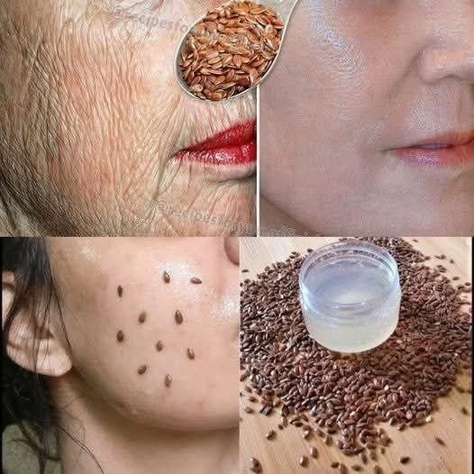 Selbst mit 70 Jahren können Sie es gegen Falten anwenden – Ihre Haut wird straffer als Glas! Wirkt stärker als Botox!