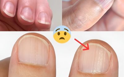 Arzt enthüllt 7 Gesundheitsprobleme, die sich in Ihren Nägeln verbergen
