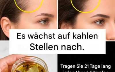 Nelkenöl, Rosmarin und Lorbeerblatt: fördern das Haarwachstum bei kahlen Stellen